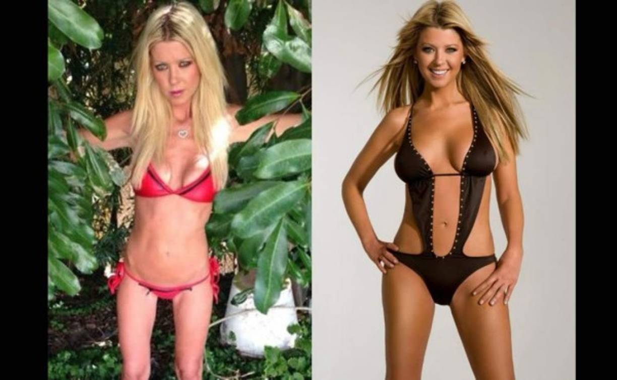 Tara Reid sorprendió hace años por el aspecto de su abdomen, su trasero y ahora, por su extrema delgadez.