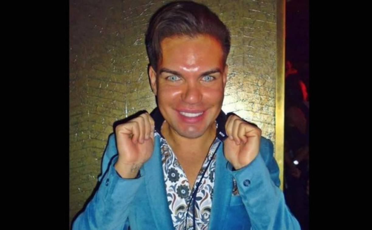 El ‘Ken’ humano dice que no le preocupa que su cuerpo y su cara se afecten con el paso de los años porque “hay tanta tecnología y procedimientos que no pienso en eso, ustedes incluso en su país tienen a los mejores doctores”, aseguró.