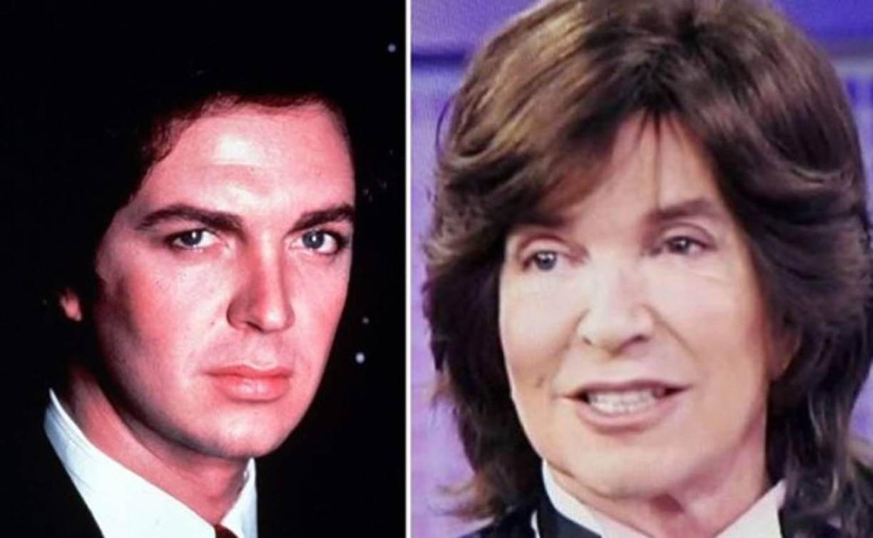 Camilo Sesto apareció con un rostro casi irreconocible. Sus labios visiblemente más finos, con los pómulos más resaltados y sin bolsas, ni patas de gallo.