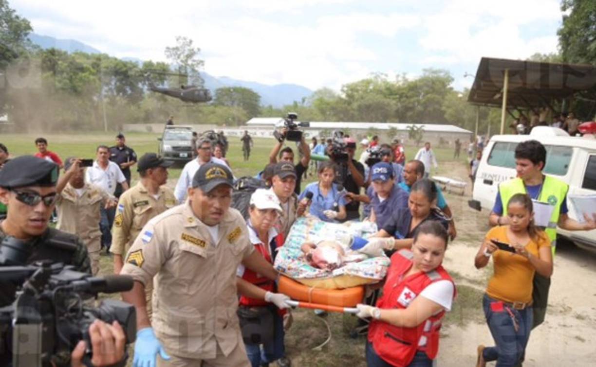 Tres menores de edad fueron trasladadas desde Yoro en helicóptero para ser atendidas en el hospital Mario Rivas.