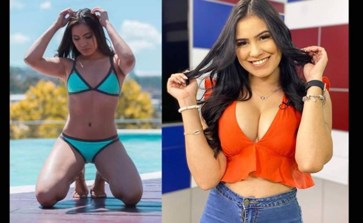 Entre las cirugías de Alejandra destacan el aumento de senos.