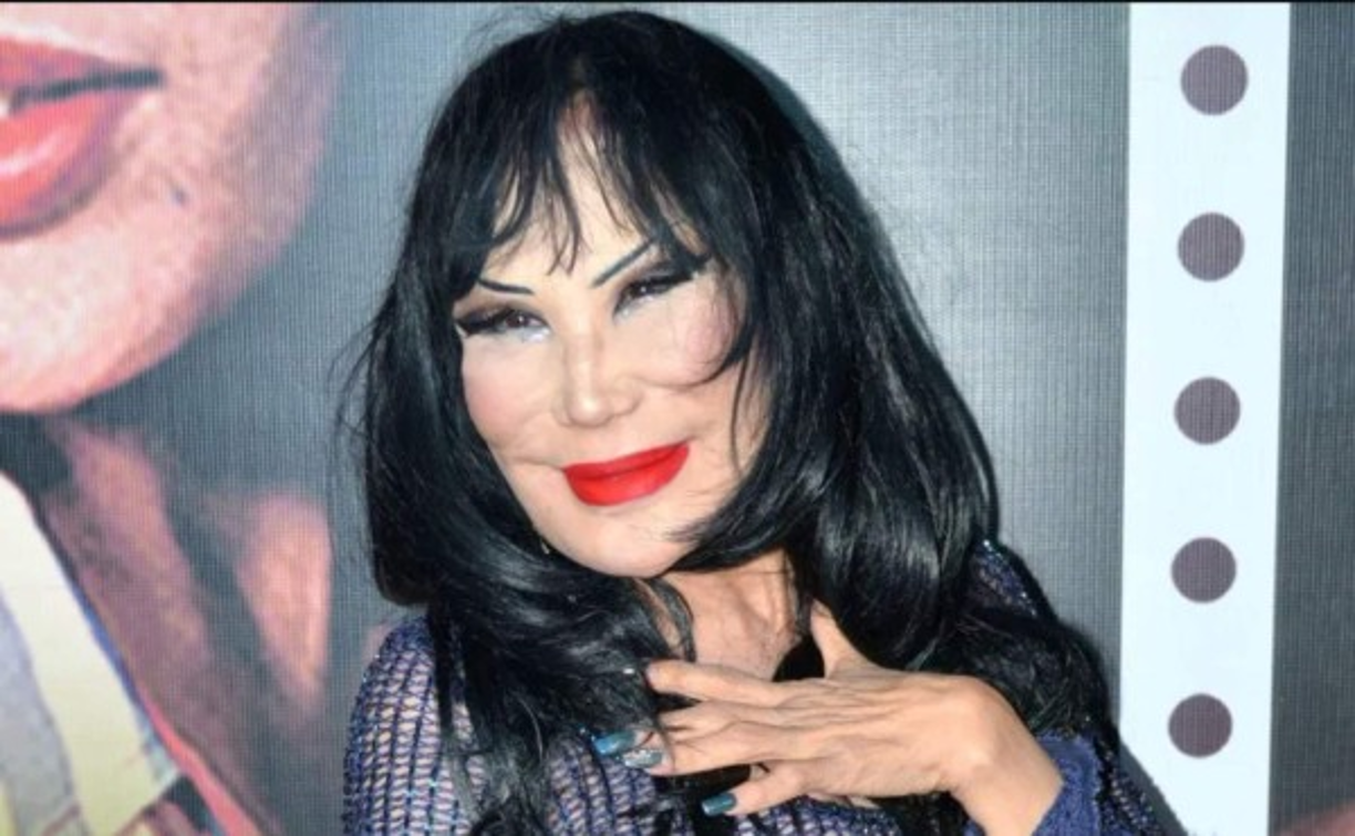 El especialista dijo que a la actriz le gusta el busto grande y que le gustaría tener algo más 'revelador' y provocativo, así mismo hacerse otro retoque en su rostro.