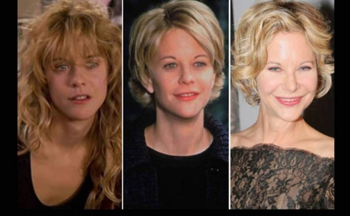 En su aparición en el desfile del diseñador George Chakra, Ryan posó irreconocible: sus ojos mucho más pequeños y rasgados, sus pómulos mucho más marcados, la barbilla más estilizada y los labios, mucho más finos.