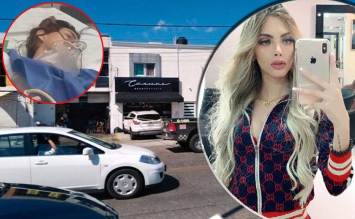 La modelo e influencer venezolana Cheyla Navarro resultó herida tras balacera en una estética en Guadalajara, México.