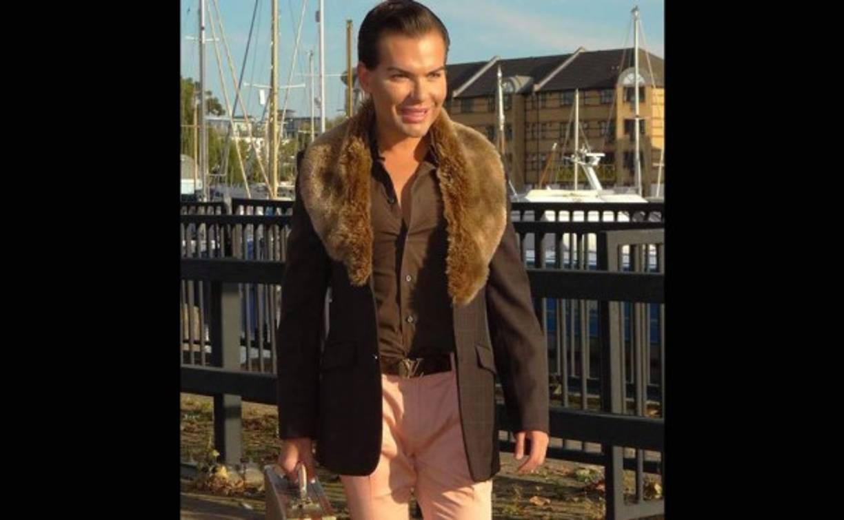 Rodrigo contó cómo recientemente estuvo a punto de perder ambos brazos debido a una negligencia médica. Su intención era la de aumentar el tamaño de los bíceps, pero una bacteria en el quirófano casi le cuesta la vida.