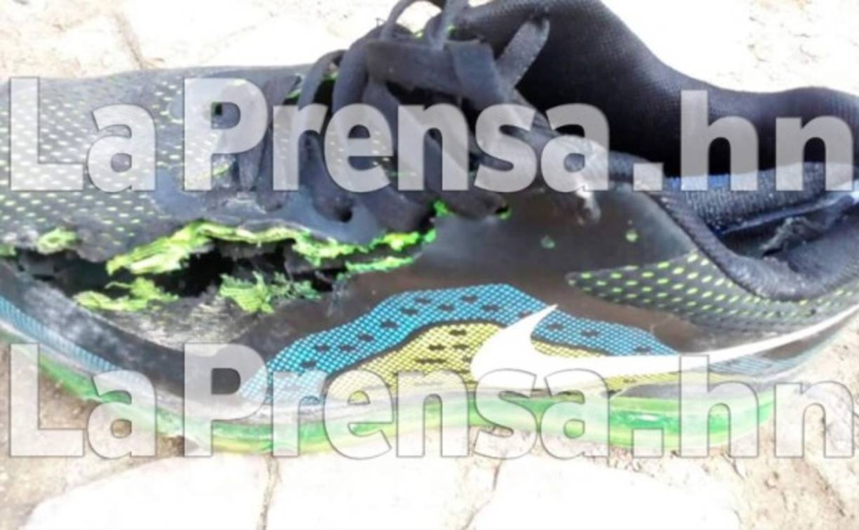 Los zapatos de Ángel Rigoberto Mejía quedó rajado tras ser alzanzado por un rayo en el barrio Erandique de Lempira.