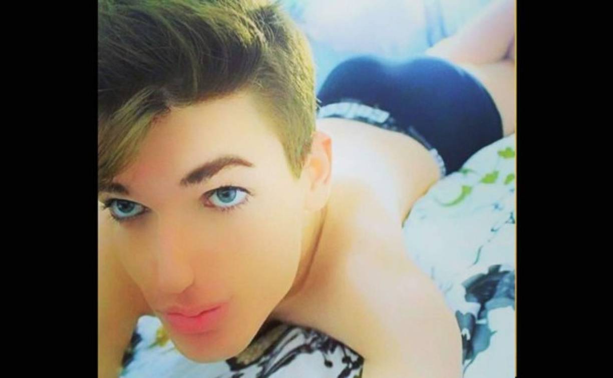 En Brasil, Rodrigo Alves se ha sometido a más de 24 cirugías para lograr el mismo objetivo.