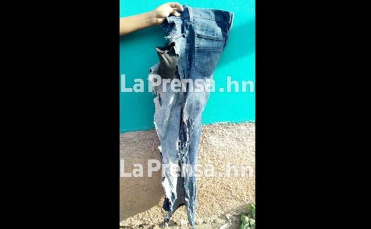 También el pantalón de Ángel Rigoberto Mejía quedó destruido por la descarga eléctrica de un rayo en el barrio Erandique de Lempira.