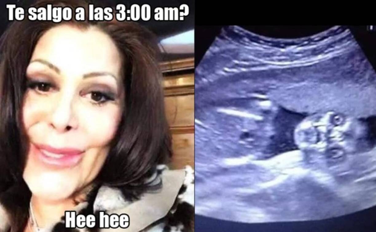 El Ayuwoki se hizo viral luego de una parodia al 'Rey del pop', Michael Jackson.