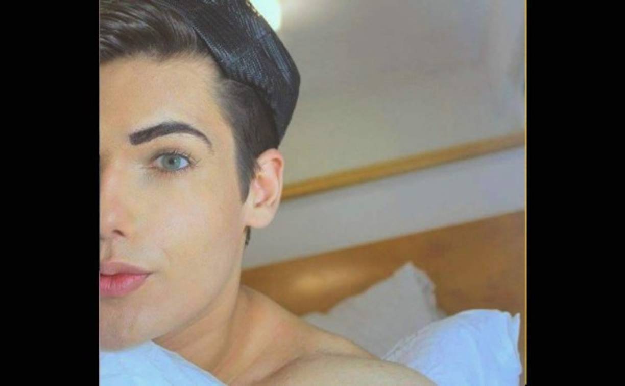 El joven brasileño se había gastado más de 46 mil dólares en operaciones para parecerse al exnovio de la muñeca Barbie tras ganar un concurso de modelaje a los 16 años, según reportó el Daily Mail.