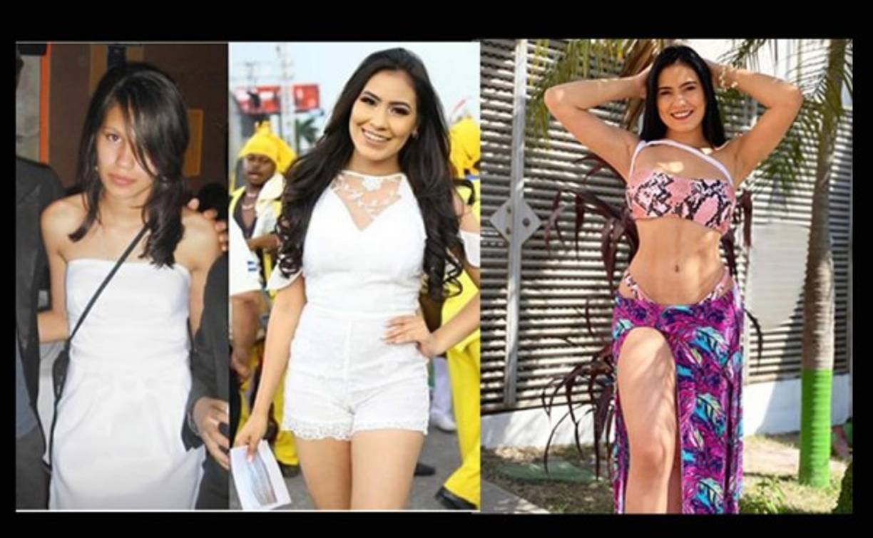 <a href='https://www.laprensa.hn/fotogalerias/farandula/1361142-411/alejandra-rubio-publica-fotos-sin-censura-tras-cirug%C3%ADa-plastica?i=1' style='color:red;text-decoration:underline' target='_blank'>MIRA: Alejandra Rubio publica fotos sin censura tras cirugía plástica</a>