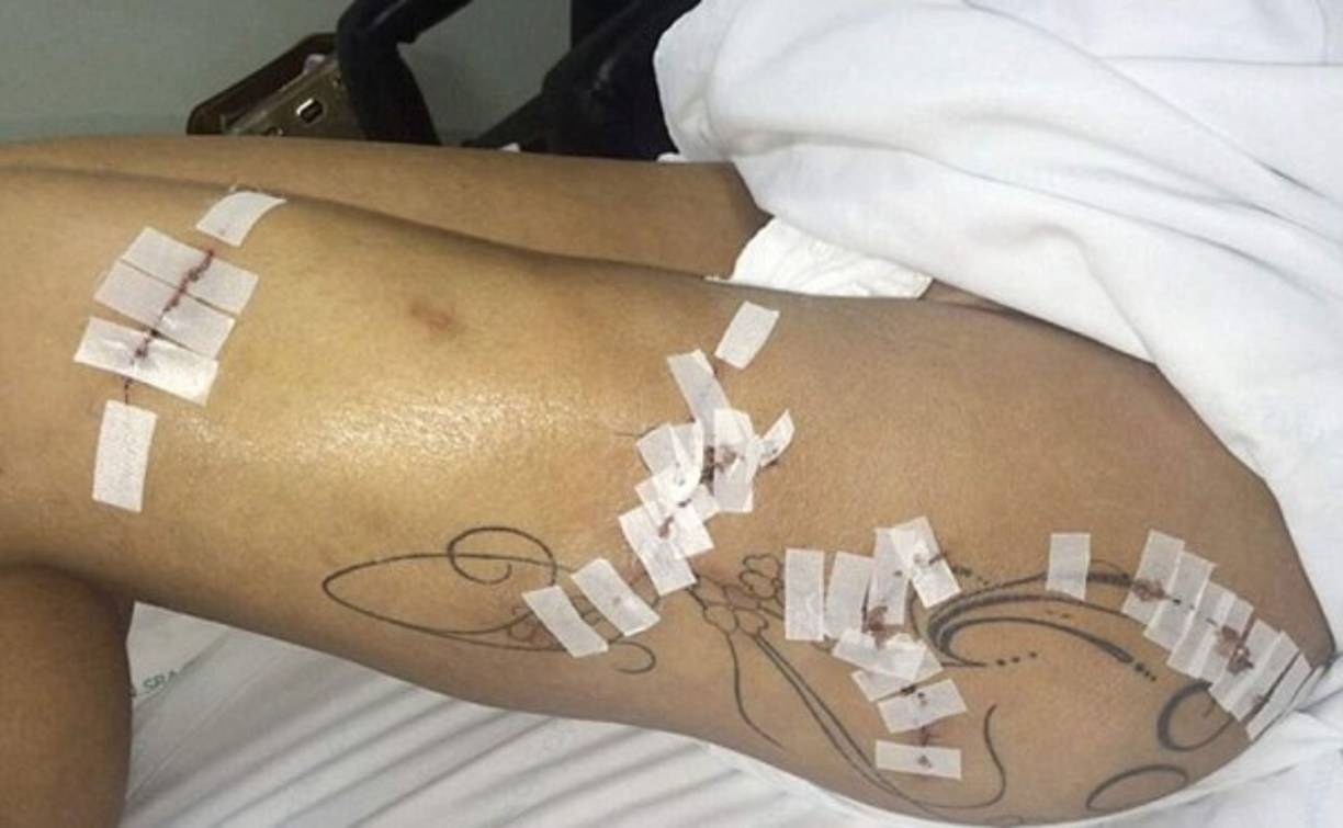 Estas imágenes de la modelo en el hospital han causado conmoción.