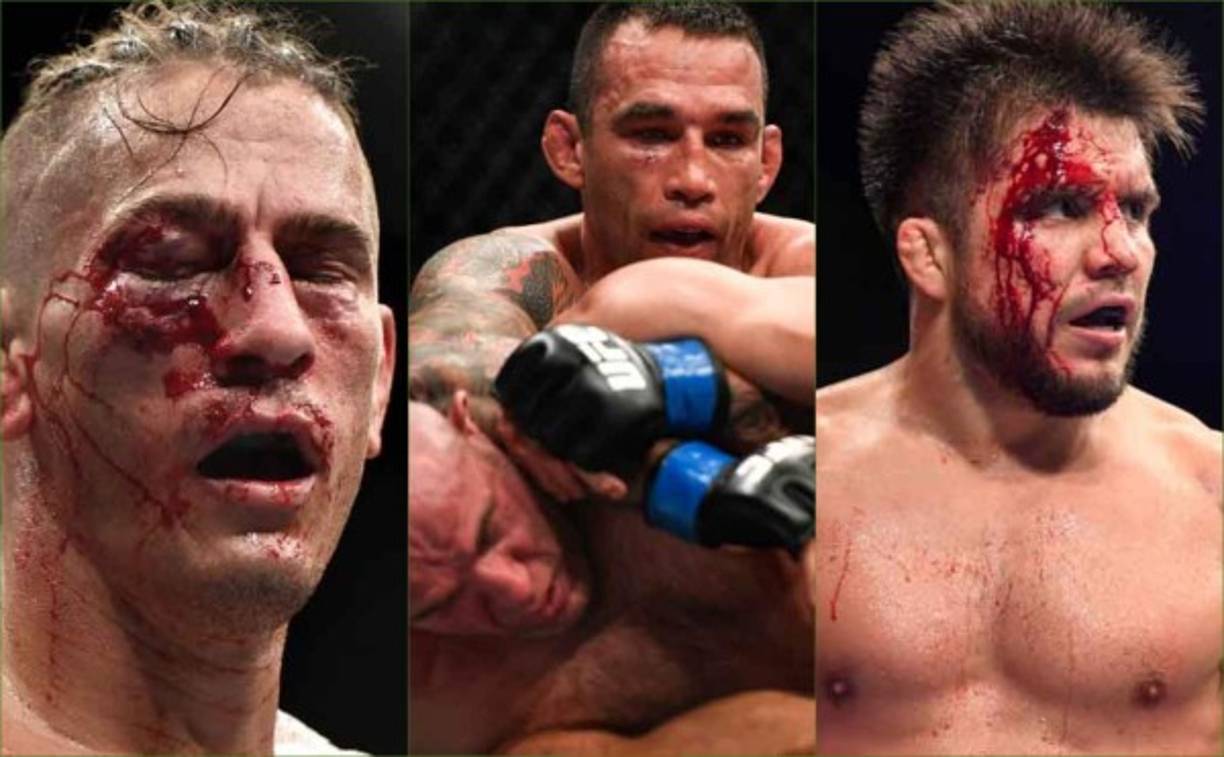 La UFC hizo su regreso en medio de la pandemia de coronavirus que ha obligado a cancelar casi la totalidad de eventos deportivos alrededor del mundo.Te mostramos las impactantes imágenes del rostro de algunos peleadores tras los combates. Fotos AFP.