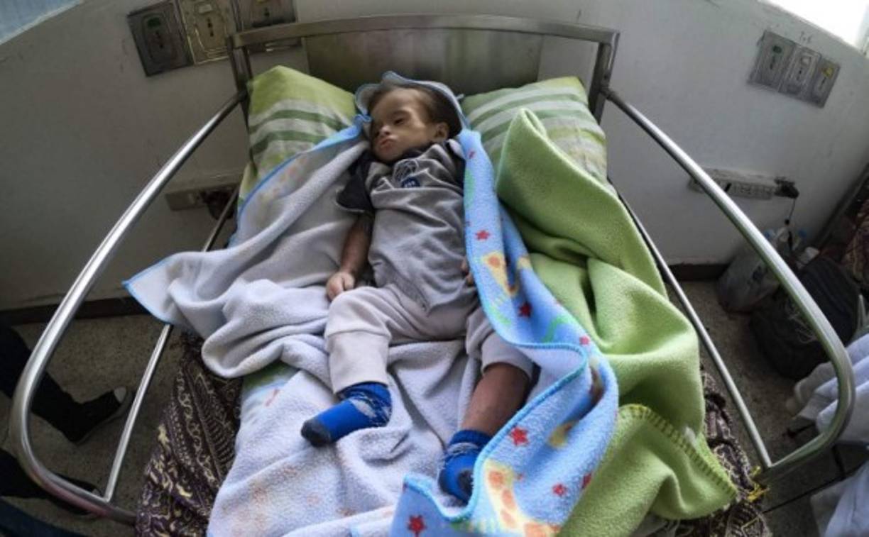 Según el Parlamento de mayoría opositora, Venezuela vive una 'emergencia nutricional', con un retardo de crecimiento que afecta a un 33% de niños pobres de 0 a 2 años.