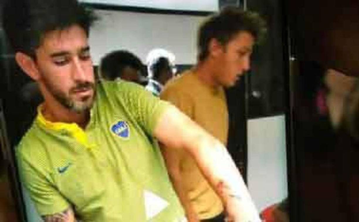 El capitán Pablo Pérez de Boca Juniors fue uno de los más afectados y tuvo que se trasladado a un hospital. Tiene astillas en los ojos producto de los vidrios rotos y que el otro futbolista tiene un corte en la parte superior de la cabeza'.