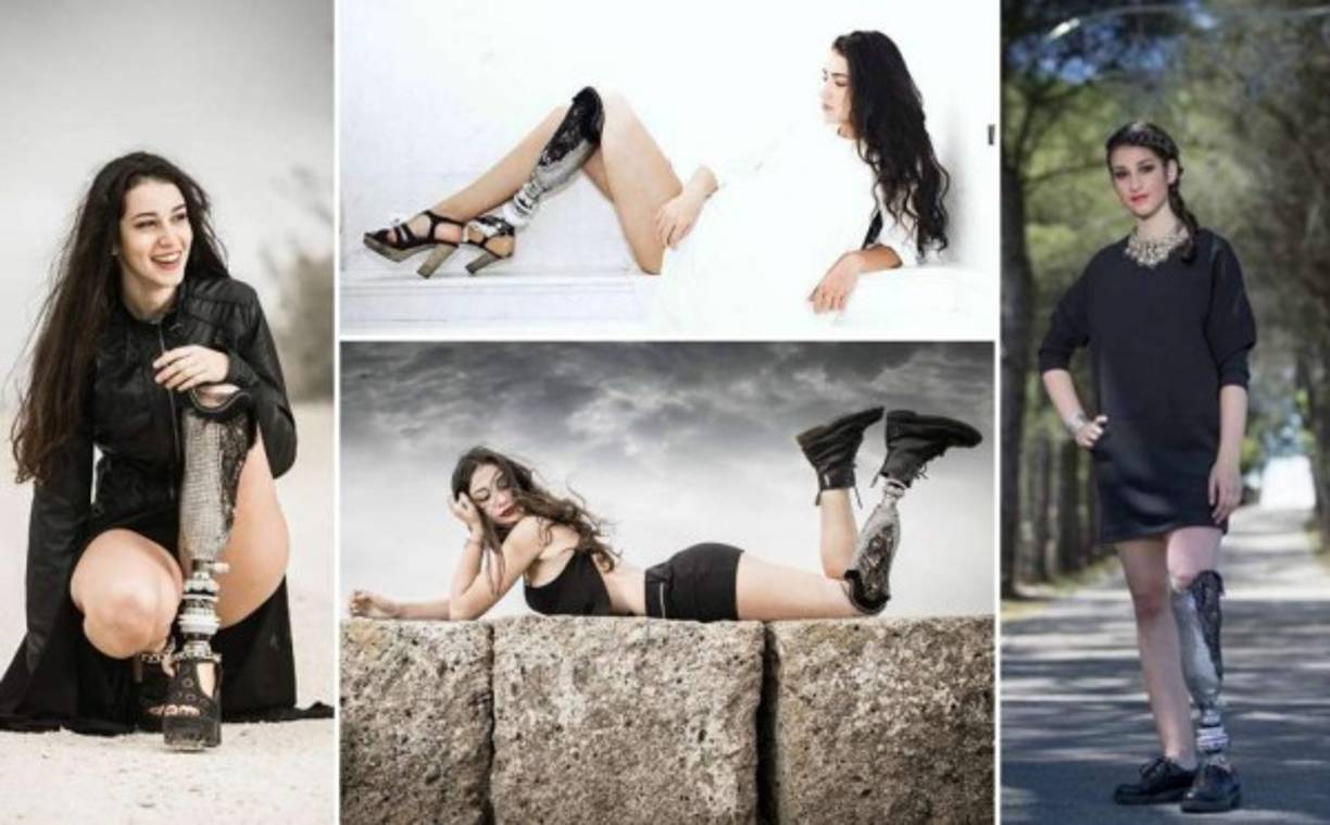 Chiara Bordi ha demostrado al mundo que un accidente u una enfermedad no pueden frenar tus sueños. Su mayor anhelo es que en los concursos internacionales comiencen a aceptar a modelos con condición como ella.