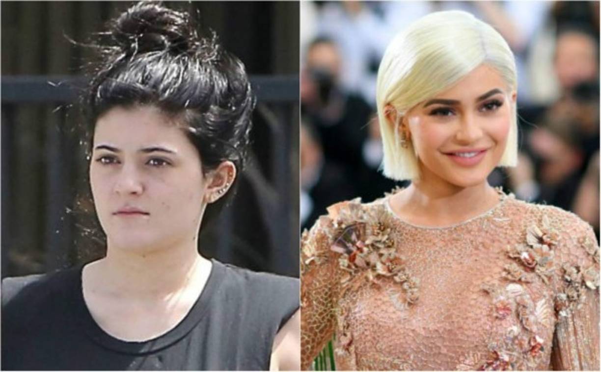 El antes y después de la menor de la clan de las Kardashian.