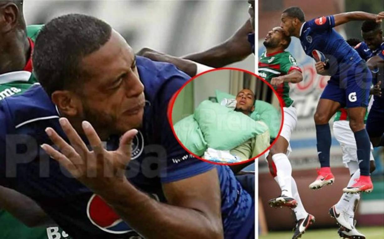 Las imágenes del terrible cabezazo que se llevó Eddie Hernández en un choque con Caue Fernandes y que lo mandó al hospital. Será operado.