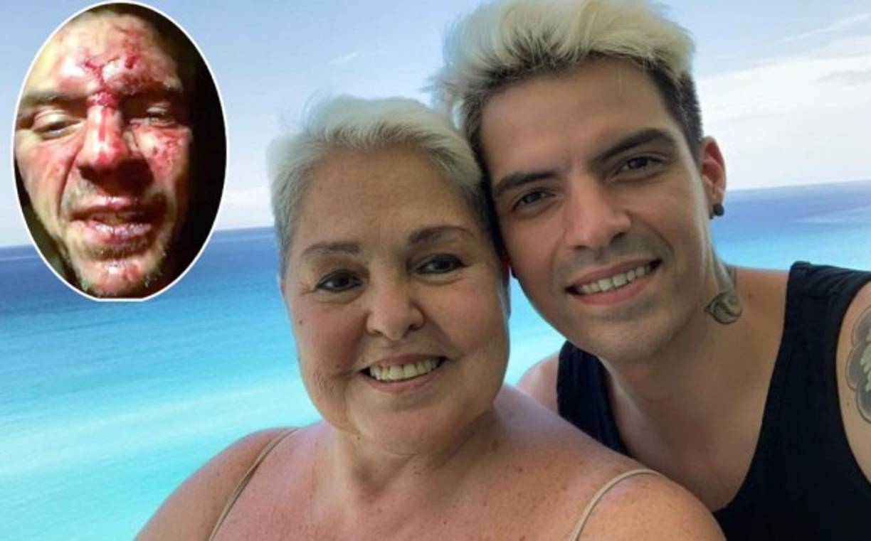 Tremenda golpiza recibió hace algunos días César D'Alessio, hijo de Lupita D'Alessio, mientras presentaba su show en una fiesta de una casa particular en el Estado de México. Este martes salen a luz nuevos detalles sobre lo ocurrido.