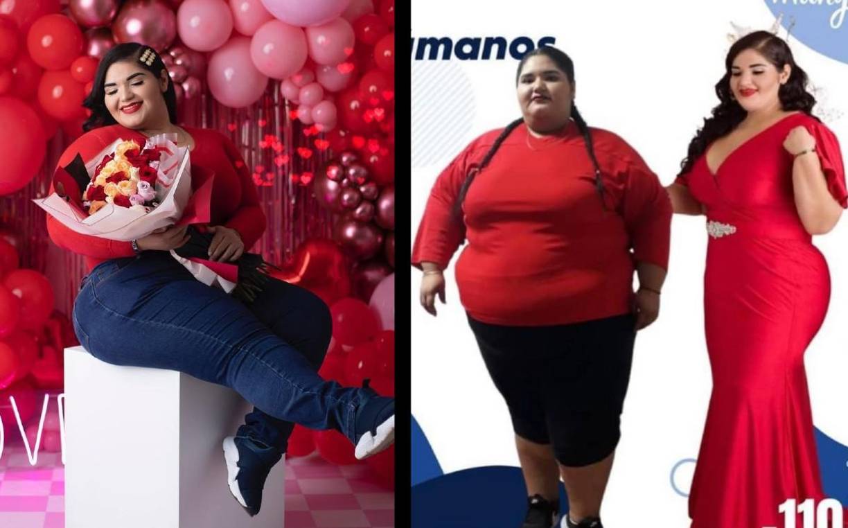 Magnolia Karolina Morales Camacho, nombre completo de la celebridad de internet, tuvo que ingresar nuevamente al hospital para que le hicieran otra cirugía ya que tenía una fuga gástrica.