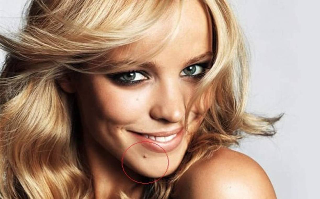 Personas con lunares en la barbilla son consideradas como gentes muy generosas, también son aventureras y muy apasionadas en todo lo que hacen.<br/><br/>También es considerada como una persona trabajadora, responsable, respetuosa y capaz de aceptar las responsabilidades que la vida le ponga enfrente.