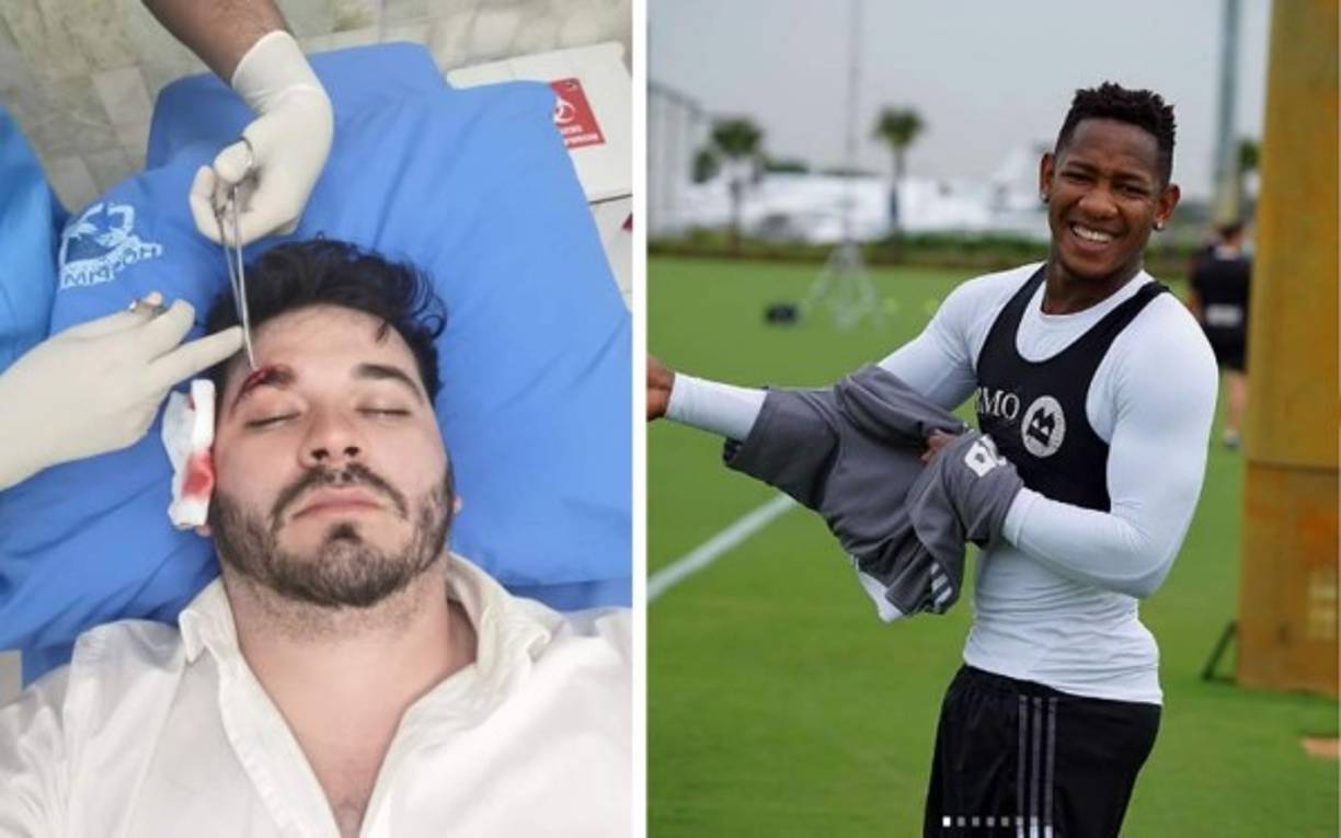 A Romell Quioto se le acusó de mandar a golpear supuestamente al novio de Malubi Paz, su expareja. “Fue puro show. Pura película, en ningún momento hubo agresión. Yo no soy de andar peleando en la calle“, dijo el jugador en su momento.