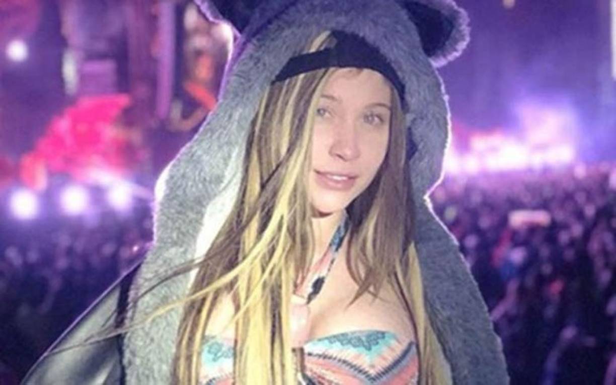 La más reciente de las muertes es la de Kenny, una modelo venezolanda que fue desfigurada con ácido.