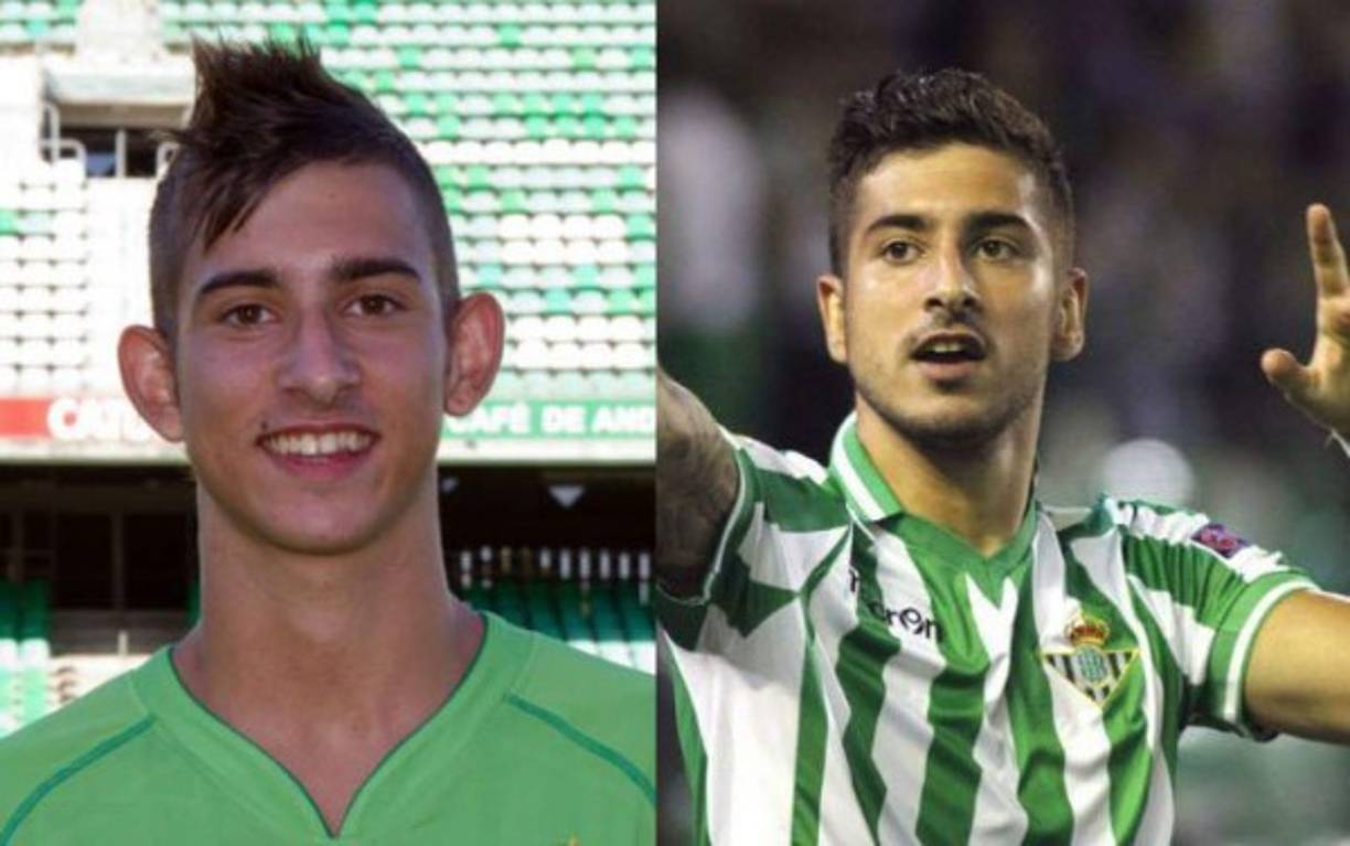 Álvaro Vadillo: Se hizo una cirugía estética para cambiar la forma de sus orejas. es un futbolista español. Juega de extremo y actualmente juega en el Granada Club de Fútbol de la Segunda División de España.