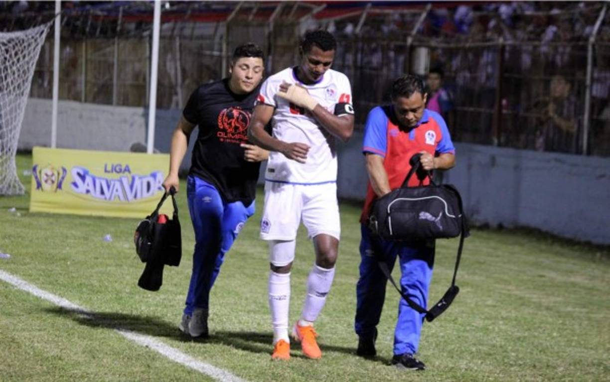 Ever Alvarado también salió con un golpe en el partido del Olimpia.