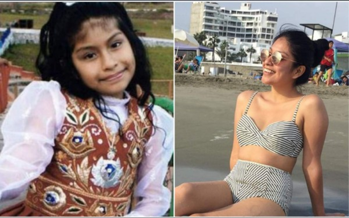 Foto del antes y después de Wendy Sulca.