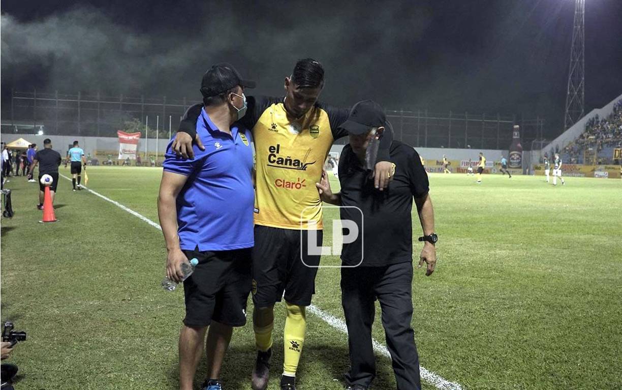 Mayron Flores salió lesionado en el Real España.