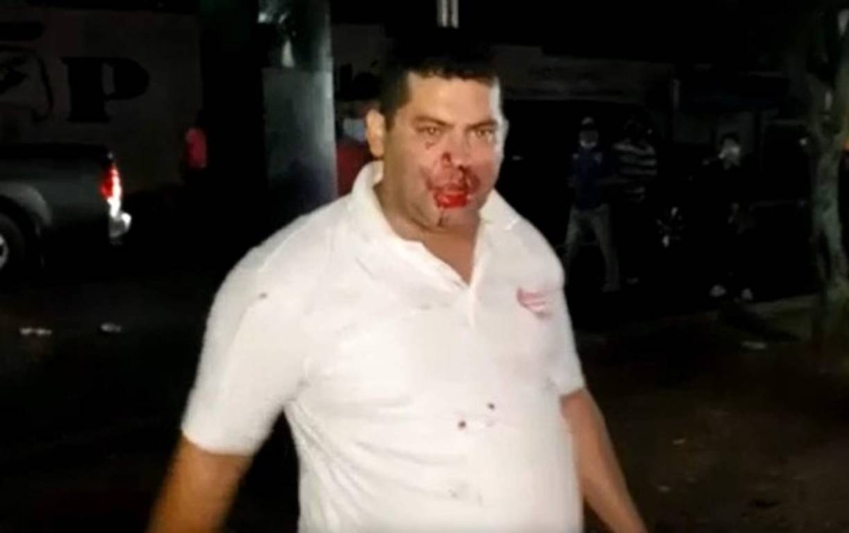 Miguel Briceño, exlíder del movimiento de las Antorchas, y militante del partido Libertad y Refundación (Libre) fue agredido por un grupo de simpatizantes nacionalistas.