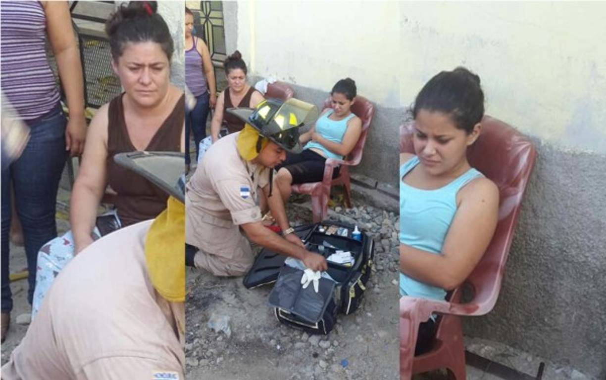 Algunos vecinos sufrieron quemaduras leves.