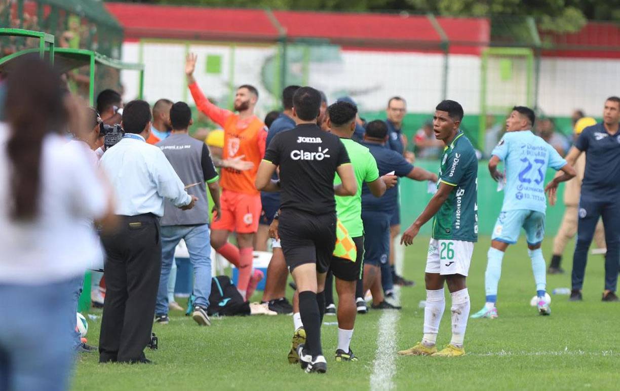 El juego se puso caliente en varios tramos. 