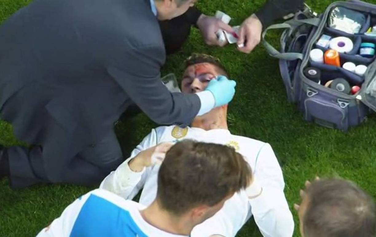 Ronaldo estuvo siendo atendido por varios minutos en el césped del estadio Santiao Bernabéu.