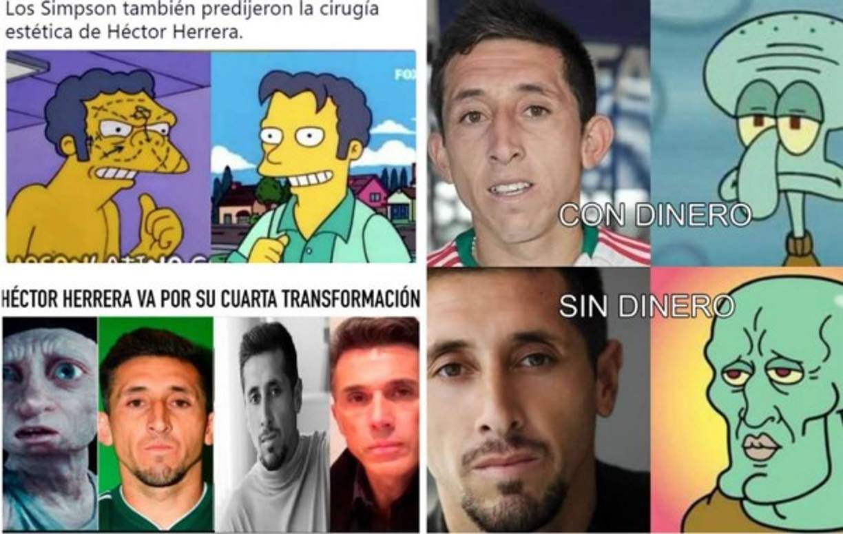 El jugador mexicano Héctor Hererra modeló en una sesión de fotos para revista de moda tras la cirugía estética que se realizó y los memes no tardaron en salir.