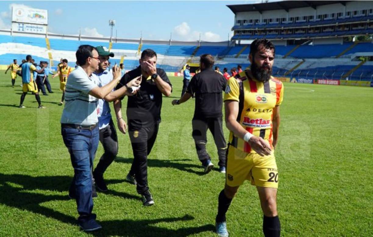 Martín 'Tato' García, entrenador del Real España, terminó caliente al final del partido.