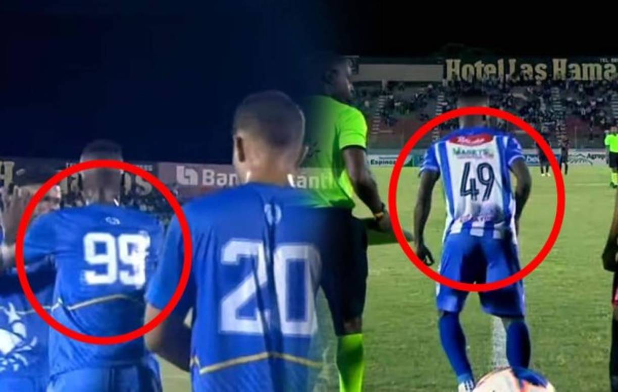 El futbolista colombiano del Victoria, Andrés Rentería, ha jugado con dos números de camisa en la Liga Nacional. El sábado jugó con el 99 en la espalda ante Real Sociedad y en la jornada anterior contra Motagua lo hizo con el dorsal 49.