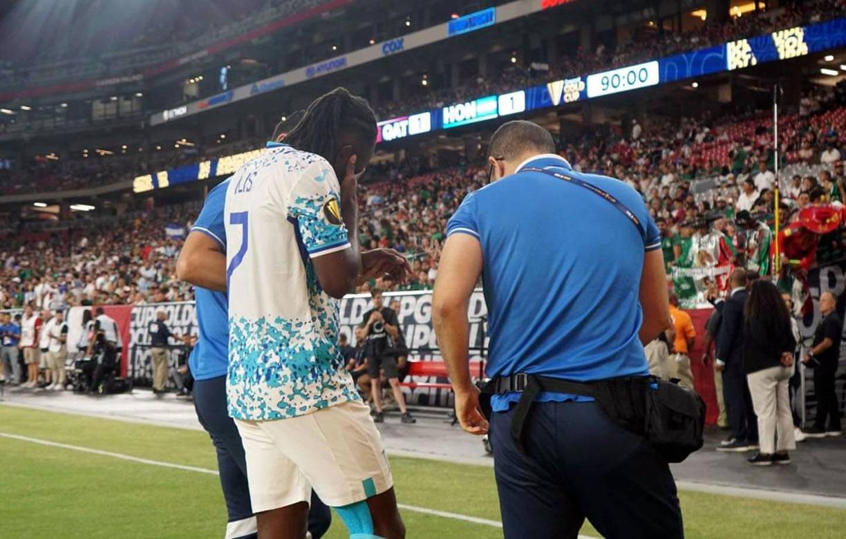 Alberth Elis salió del campo con gestos de mucho dolor en su brazo izquierdo. Drama tremendo en la Selección de Honduras.