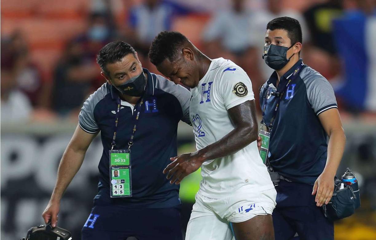 Romell Quioto (Honduras) - El ‘Romántico‘ es otra de las sensibles bajas de la selección catracha debido a una lesión que lo apartó de las canchas por varios meses.