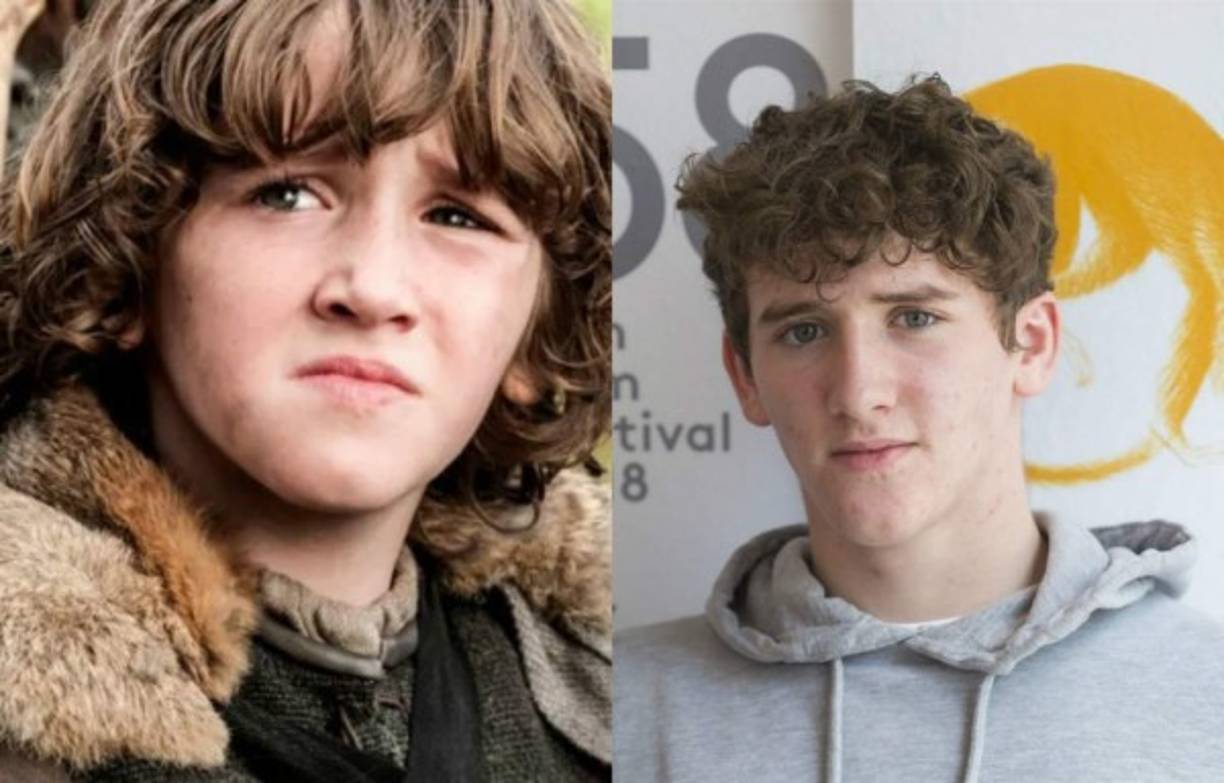 El más joven de la familia Stark fue encarnado por Art Parkinson. Este pequeño actor irlandés tenía 9 años cuando comenzó a grabar la serie.<br/><br/>El personaje Rickon Stark murió en la sexta temporada de la serie.<br/><br/>Después de despedirse de la serie Parkinson, ahora de 17 años, ha puesto voz a Kubo y las dos cuerdas mágicas y apareció en Zoo.<br/><br/>