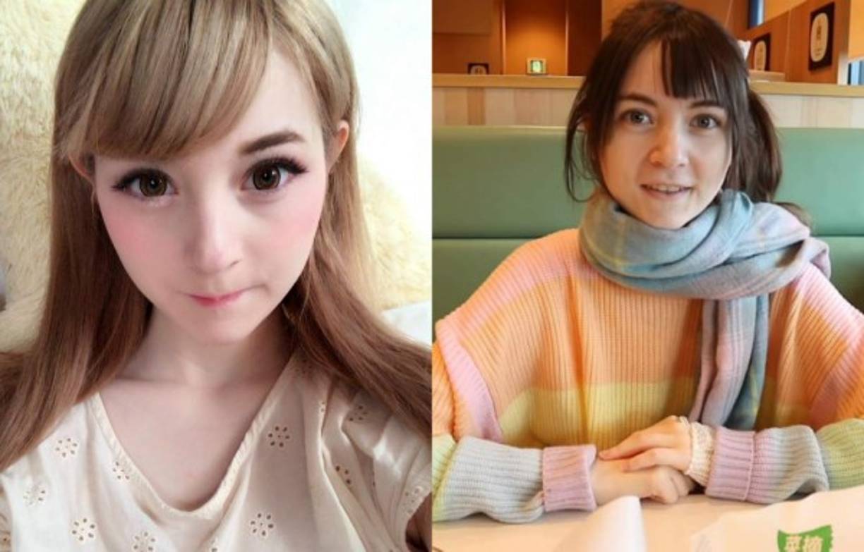 Palermo investigó al doctor en cuestión y se dio cuenta que estaba demandado por la muerte de un paciente, sin embargo esto no le importó y decidió quitarse 120 centímetros de intestino.