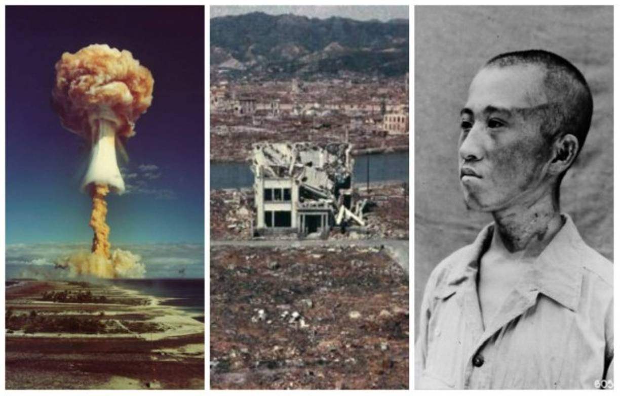 Se calcula que para fines de 1945, alrededor de 210.000 personas habían muerto como consecuencia de los bombardeos nucleares, 140.000 en Hiroshima y 70.000 en Nagasaki. Las secuelas continúan hasta ahora.