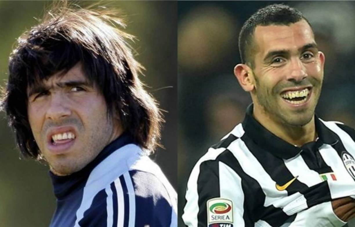 Carlos Tévez es de lo que más ha pasado por el quirófano.