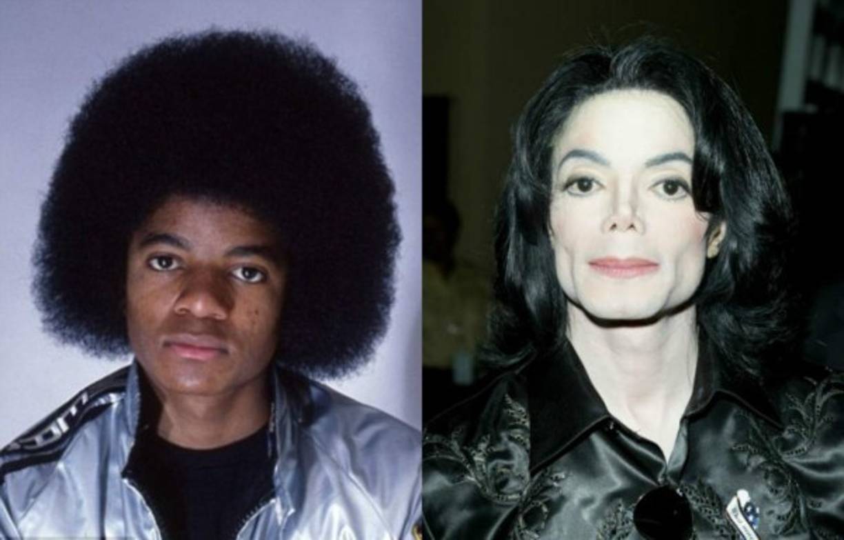 9- Su radical cambio: Michael Jackson pasará a la historia, no solo por su extraordinario talento, también por ser el único hombre que nació siendo negro y murió como blanco.<br/><br/>Una de las teorías era que se «desteñía» por culpa del vitíligo, una patología adquirida que provoca la despigmentación de la piel.<br/><br/>Otros sugiere que Jacko se sometió a un tratamiento para blanquear su piel.<br/>