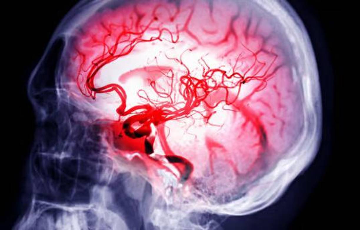 ¿Qué es esta enfermedad y que riesgo representa para los pacientes? 