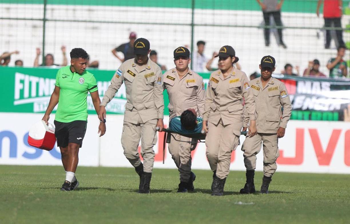 Una mala noticia en Marathón: Allans Vargas se lesionó y es de gravedad. El zaguero se pierde lo que resta del Torneo al sufrir lesión de tibia y peroné. 