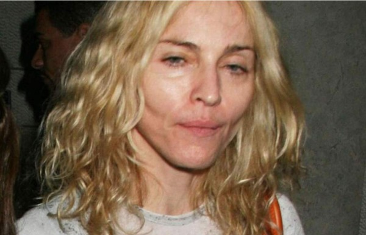 Madonna preocupó a sus fans luego de que fue captada con un desmejorado aspecto físico.