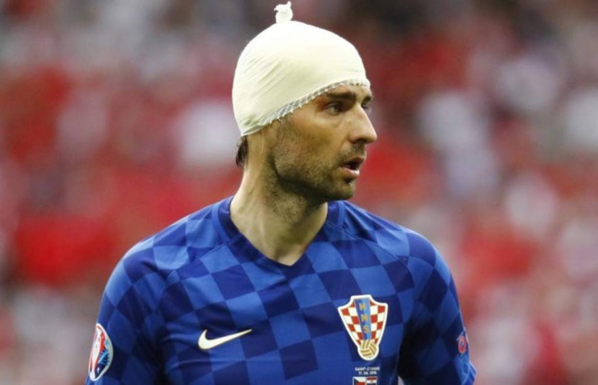 Antes de usar su gorro de waterpolo, Corluka sufrió un golpe en la cabeza y fue auxiliado para evitar las hemorragias.. Foto EFE.