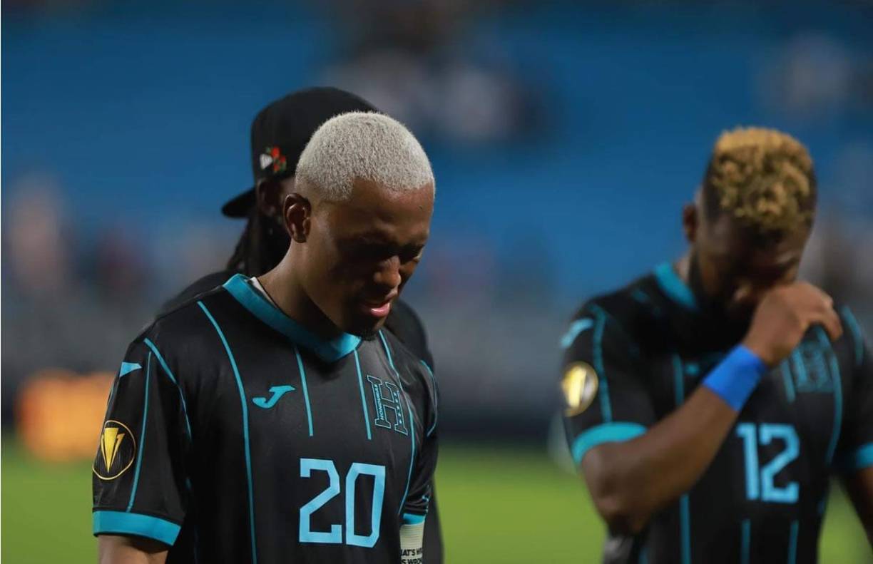 Deiby Flores se fue del campo con un problema en el ojo derecho.